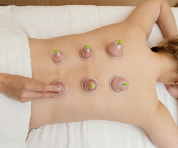 woman-experiencing-cupping-therapy-scaled-1-1024x576